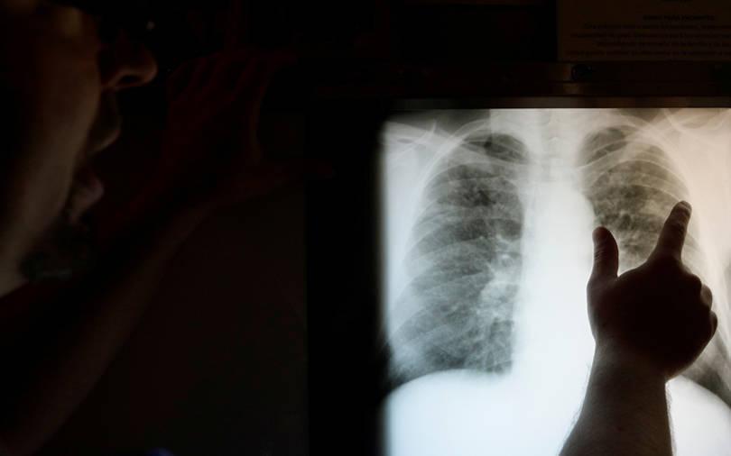 CIIE, Axilor and Unitus back radiology platform 5C Network